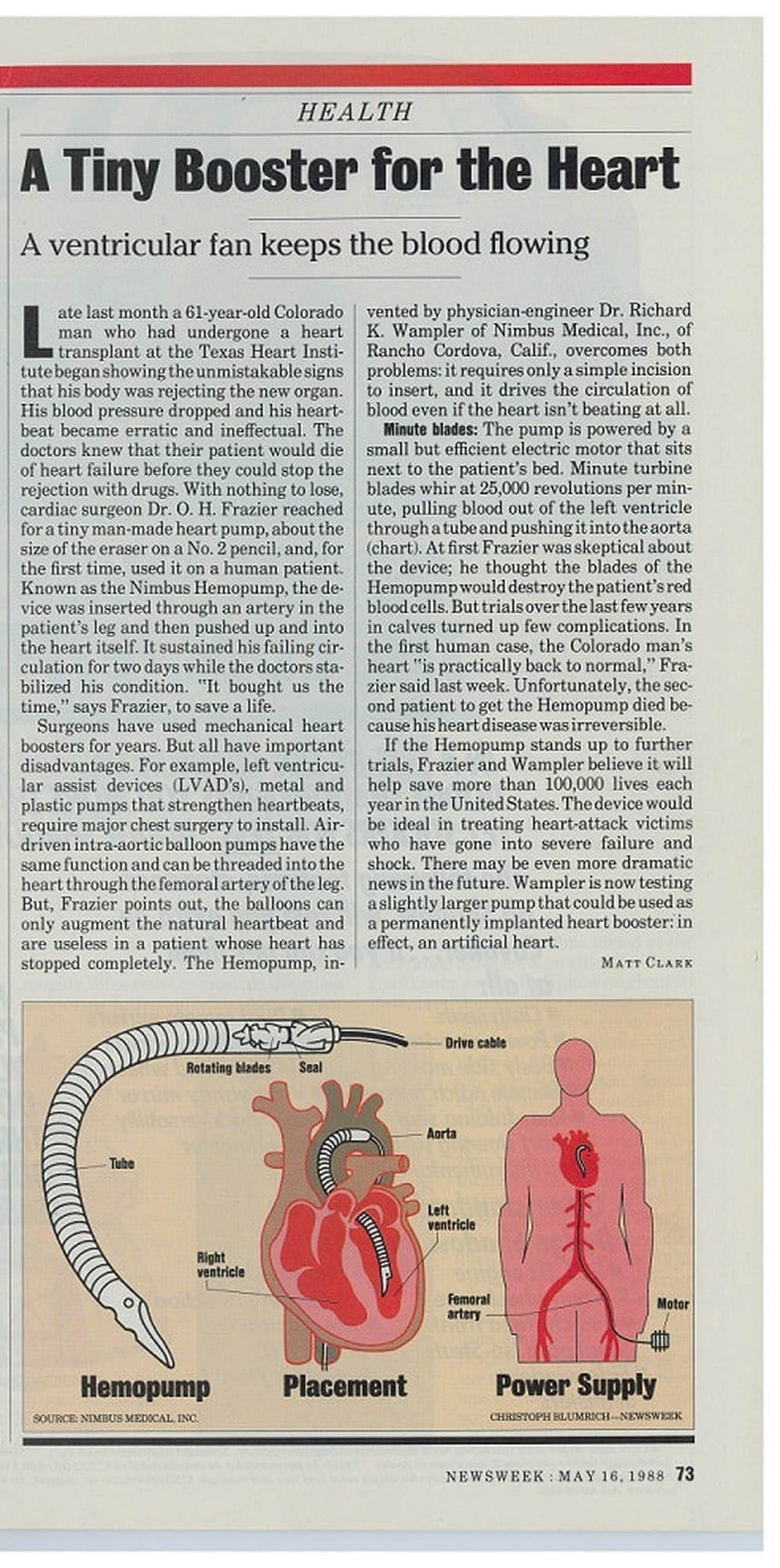 Newsweek Magazine May 1988 article on the Hemopump