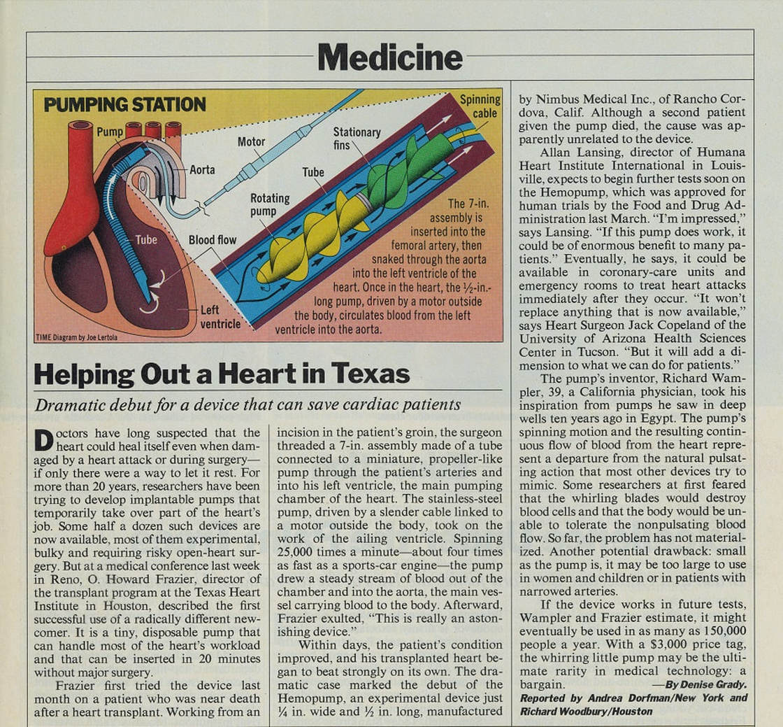 Time magazine article from May 1988 on the Nimbus Hemopump